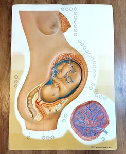 Vintage Anatomy Illustration Pregnancy Plastic Poster Medical Decor - Picture 1 of 9