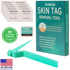 Micro Skin Tag Remover tool Kit Painless Device for Wart Acne Skin Tags removal - Picture 1 of 9