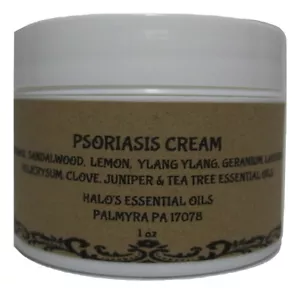 Psoriasis & Rosacea Treatment Cream With Niacinamide 1 oz Halo's Essential Oils - Picture 1 of 3