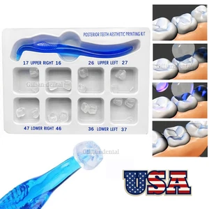Posterior Teeth Aesthetic Printing Kit Dental Light Cure Restoration Filling - Bild 1 von 7