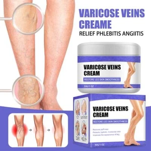 Treatment Legs Varicose Veins Cream Vein Care Fading Cream Herbal Ointment - Picture 1 of 10