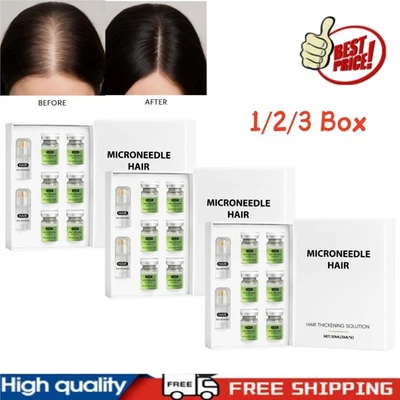 1/2/3Set Hair Regrowth System, Advanced Hair Treatment Ginseng  30ML ❀ - Bild 1 von 4