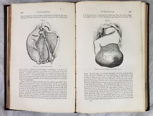 1863 Clinical Lectures on Diseases of Women J.Y. Simpson w 102 Wood Engravings - Foto 1 di 21