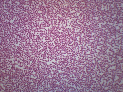 Frotis de sangre de pez - Diapositiva de microscopio preparada - 75x25 mm - Eisco Labs Foto 1 de 2