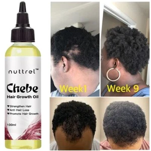 Grow Your Hair Faster Longer in 1 Week Hair Loss Treatment Chebe Powder Hair Oil - Picture 1 of 21