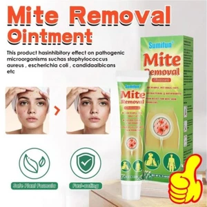 Crema para el cuidado de ácaros y piojos 20 g pomada eliminación de ácaros EE. UU. - Imagen 1 de 8