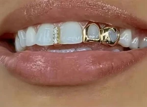 Custom Fit 14K Gold Plated Mouth Teeth Open Face Heart + Iced Gap Grillz Cap Set - Picture 1 of 4