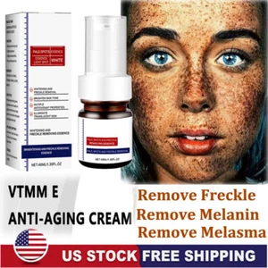 Effective Whitening Freckle Cream Remove Dark Spot Cream Removal Melanin Melasma - Picture 1 of 15