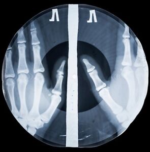 X-Ray USSR Record Roentgen Bones Ribs Music Vinyl Amerikan Night Jim Morrison