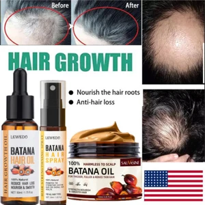 Batana Oil Serum Spray for Hair Growth Healthier Thicker Fuller Anti Hair Loss - Picture 1 of 37