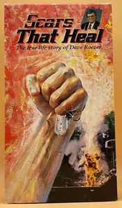 Scars That Heal 1993 The True Life Story of Dave Roever Vietnam **Buy 2 Get 1** - Picture 1 of 3