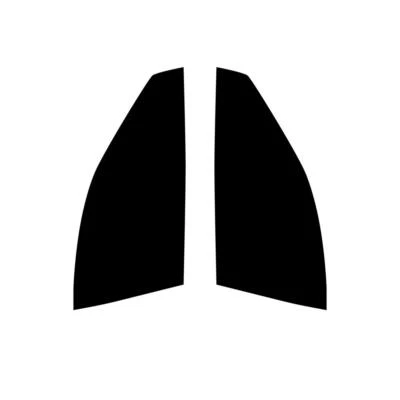 Pre Cut Car Window Tint for Lexus IS 4-door Berlina 2014+ Front Film - Image 1 of 4