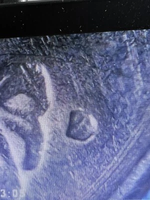 1979 D Washington Quarter Filled D Mint Mark Error Was S As You Can See It. - Image 1 of 4