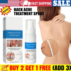 Magnesium Herbal Soothing Spray Herbal Relief Spray für Juckreiz 50ml - Bild 1 von 9