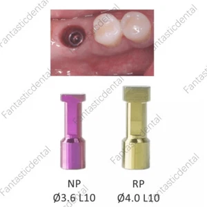 Dental Nobel Analógico NP RP Réplica NOB Hex Activo Pilar Estrecho Regular Biocare - Imagen 1 de 15
