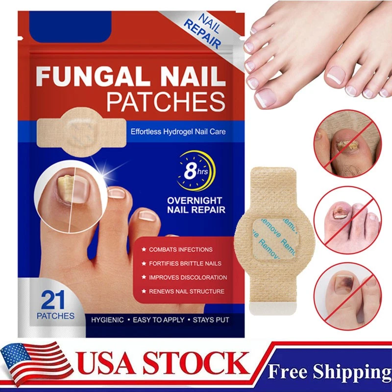 Parches de uñas para hongos 21 ~ 105 piezas - Tratamiento de hongos en las uñas de los pies extra fuerte durante la noche Foto 1 de 4