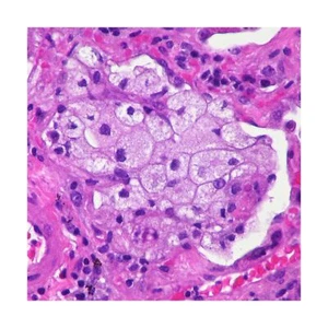100-Set Prepared Microscope Pathology Slides for Human Medical Education - Picture 1 of 3
