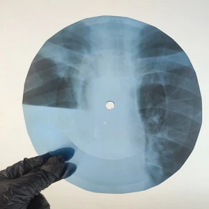 DAVID BOWIE THE BEWLEY BROTH X-Ray USSR Record Roentgen Bone Ribs Music Vinyl - Picture 1 of 2