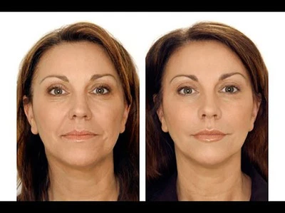 Lefery Active Cell Regeneration Anti Ageing Cream Day & Night Cream UK Seller - Image 1 of 4