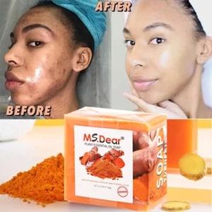 1-3X Turmeric Soap Bar for Face&Body-Tumeric Soap, Acne, Dark Spots, Smooth Skin - Picture 1 of 27