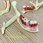 Dental Anatomical Model Disease Teaching Study Demonstration Tooth Model