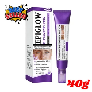 EPIGLOW MelanEX Advanced Anti-HyperpigmentationCream - Picture 1 of 13