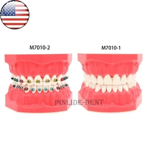 US Dental Orthodontic Model Brushing Flossing Practice Teeth Model with Brackets - Picture 1 of 22