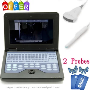 Portable laptop machine Digital Ultrasound Scanner 3.5M Convex,6.5M transvaginal - Picture 1 of 12
