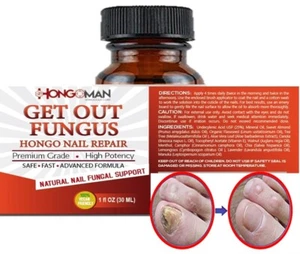 Miracle Anti-Fungal Athlete's Foot Fungus Support w/ Tea Tree Oil, 1oz - Picture 1 of 5