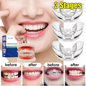Brackets correctores dentales invisibles de 3 etapas alineación retenedora - Imagen 1 de 16