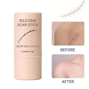 1x Silicone Scar Stick Scar Solutions 6.8g Scar Repair Cream New - Picture 1 of 10