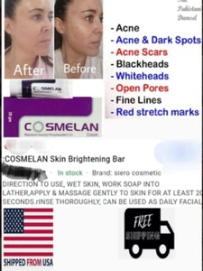 Cosmelan Treatment 25gm - Picture 1 of 4
