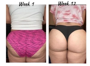 Smoothing & Firming Cream Helps Restore Natural Look, Vitamin E Cream For Bum - Picture 1 of 7