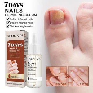 GFOUK 7 Days Nail Growth and Strengthening Serum -- UK - Picture 1 of 9