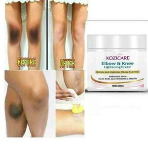 Kozicare Elbow & Knee Lightening Cream, Dark Spots Cream With Kojis Acid 50gm - Bild 1 von 7