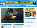 Great Hair Loss Treatment Store Website Free Installation + Free Hosting