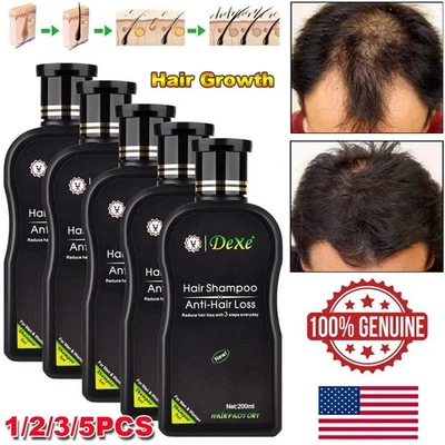 Hair Growth Shampoo Hair Regrowth Treatment Anti-Hair Loss Shampoo For Men&Women - Image 1 of 4