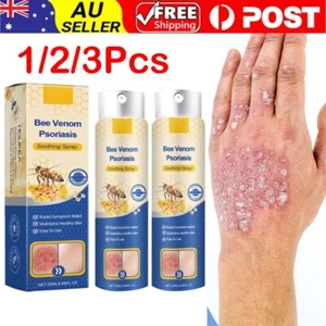 1-3X Bee Venom Psoriasis Care Spray pro Anti-itching Psoriasis Treatment Spray - Picture 1 of 16