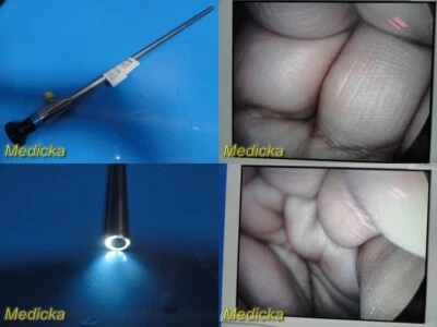 Telescopio rígido Smith & Nephew DYONICS 8000, laparoscopio, 0°x10 mm ~ 28214 Foto 1 de 4