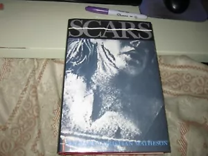 SCARS AND OTHER DISTINGUISHING MARKS – 1987 – RICHARD CHRISTIAN MATHESON - Foto 1 di 5