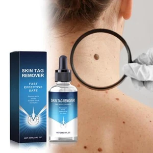 Wart Remover Serum Fast Safe Natural Treatment Skin C3J2 30ml Tags G7I7 Y8E2 - Picture 1 of 15