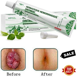 #1 Mejores Crema Para Las Hemorroides Tu Puedes Liberarte Del Dolor Y Sangrado - Picture 1 of 6