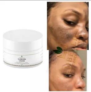 Sunburn Remover Face Cream, Dark Mark Fade Cream - 100ml - Picture 1 of 4