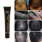 Regrowth Organic Hair Serum Roller Set Hair Care Anti Stripping Liquid #O