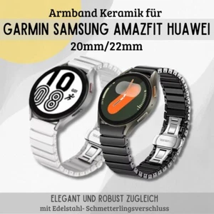 Correa Cerámica para Garmin Samsung Huawei Amazfit Watch ✅ 20mm 22mm Metal - Imagen 1 de 15