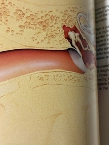 Welch-Allyn SL-1500 (1984) Guide to Diagnostic Instruments ENT Eye Ear Nose Thro - Picture 1 of 24