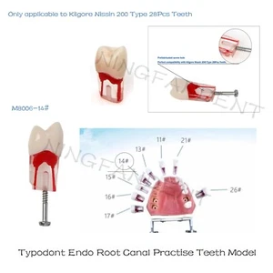 Dientes de práctica de conducto radicular endo dental modelo Nissin tipo 14#, 10/20/30/50 piezas - Imagen 1 de 16