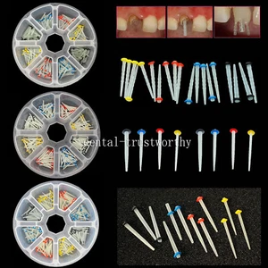 200 Pcs Dental Fiber Post Glass Quartz Teeth Restorative 1.0 1.2 1.4 1.6 1.8mm - Picture 1 of 34