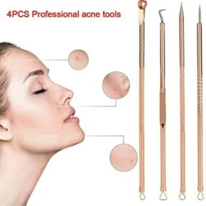 Acne Remover Blackhead Whitehead Facial Spot Pimple Popper Pore Tool Spike UK - Picture 1 of 12