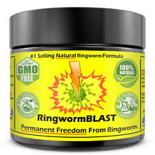 Ringworm Cream Ringworm Treatment EXTRA STRENGTH FAST ACTING 100% SAFE LARGE 2oz